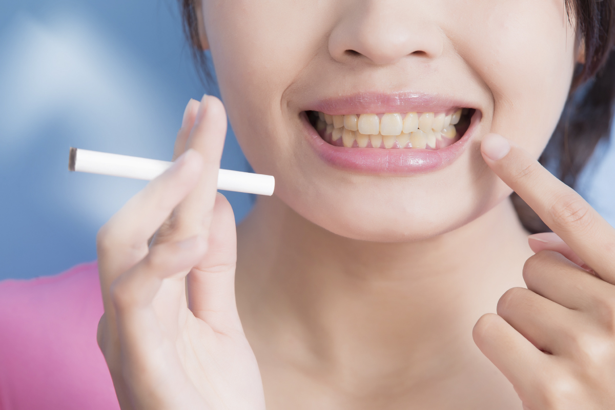 歯周病は喫煙でリスクが上がる！タバコが与える口腔への影響とは？
