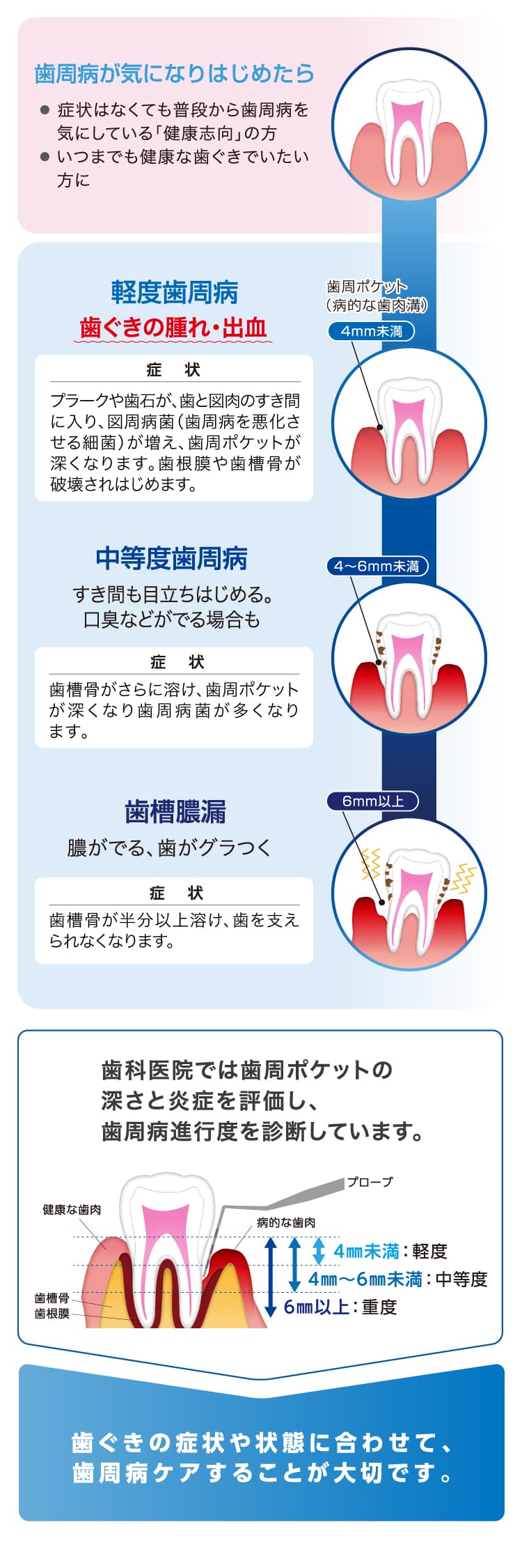 歯周病が重症化すると3