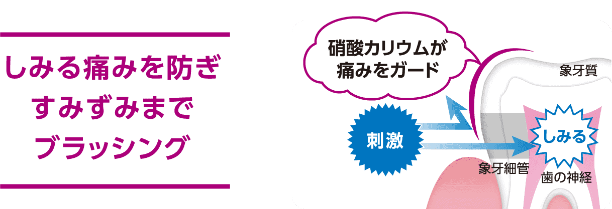 しみる痛みを防ぎすみずみまでブラッシング